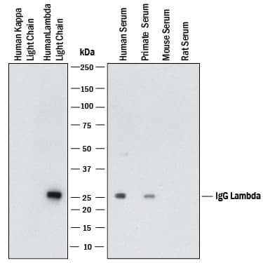 Western Blot Human lambda light chain Antibody (2496A) [Unconjugated]