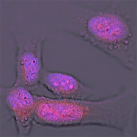 Immunocytochemistry Importin beta/KPNB1 Antibody (845208)