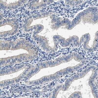 Immunohistochemistry-Paraffin: Inhibin alpha Antibody [NBP1-87563] - Staining of human endometrium shows low expression as expected.