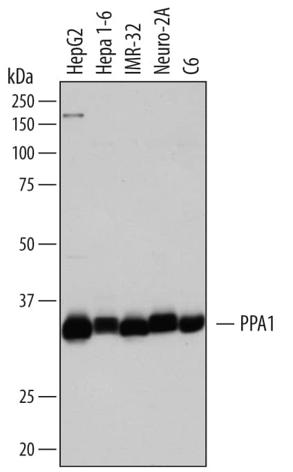 Western blot shows lysates of HepG2 human hepatocellular carcinoma cell line, Hepa 1-6 mouse hepatoma cell line, IMR-32 human neuroblastoma cell line, Neuro-2A mouse neuroblastoma cell line, and C6 rat glioma cell line. PVDF membrane was probed with 1 µg/mL of Sheep Anti-Human/Mouse/Rat Inorganic Pyrophosphatase/PPA1 Antigen Affinity-purified Polyclonal Antibody (Catalog # AF6557) followed by HRP-conjugated Anti-Sheep IgG Secondary Antibody (Catalog # HAF016). A specific band was detected for Inorganic Pyrophosphatase/PPA1 at approximately 33 kDa (as indicated). This experiment was conducted under reducing conditions and using Immunoblot Buffer Group 1.