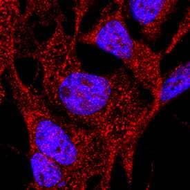 Integrin a8 was detected in immersion fixed 4T1 mouse breast cancer cell line using Goat Anti-Mouse Integrin a8 Biotinylated Antigen Affinity-purified Polyclonal Antibody (Catalog # BAF4076) at 10 µg/mL for 3 hours at room temperature. Cells were stained using the NorthernLights™ 557-conjugated Streptavidin (red; NL999) and counterstained with DAPI(blue). Specific staining was localized to cytoplasm and cell surface. View our protocol for Fluorescent ICC Staining of Cells on Coverslips.