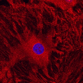 Integrin aV/CD51 was detected in immersion fixed rat mesenchymal stem cells using Mouse Anti-Human Integrin aV/ CD51 Monoclonal Antibody (Catalog # MAB12191) at 10 µg/mL for 3 hours at room temperature. Cells were stained using the NorthernLights™ 557-conjugated Anti-Mouse IgG Secondary Antibody (red; NL007) and counterstained with DAPI (blue). Specific staining was localized to cytoplasm. View our protocol for Fluorescent ICC Staining of Cells on Coverslips.