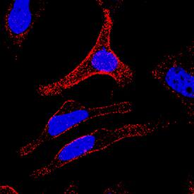     Integrin  beta 1/CD29  was detected in immersion fixed HeLa human cervical epithelial carcinoma cell  line using Mouse Anti-Human Integrin  beta 1/CD29 Monoclonal Antibody  (Catalog # MAB17782) at 25 µg/mL for 3 hours at room temperature.  Cells were stained using the NorthernLights™ 557-conjugated  Anti-Mouse IgG Secondary Antibody (red; Catalog # NL007)  and counterstained with DAPI (blue). Specific staining was localized to  cytoplasm and cell surfaces. View our protocol for Fluorescent  ICC Staining of Cells on Coverslips. 