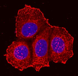 Integrin  beta 5 was detected in immersion fixed MCF-7 human breast cancer cell line using Sheep Anti-Human Integrin  beta 5 Biotinylated Antigen Affinity-purified Polyclonal Antibody (Catalog # BAF3824) at 10 µg/mL for 3 hours at room temperature. Cells were stained using the NorthernLights™ 557-conjugated Streptavidin (red; Catalog # NL999) and counterstained with DAPI (blue). Specific staining was localized to transmembrane proteins. View our protocol for Fluorescent ICC Staining of Cells on Coverslips.