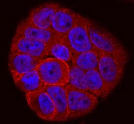 Integrin  beta 6 was detected in immersion fixed HT-29 human colon adenocarcinoma cell line using Sheep Anti-Human Integrin  beta 6 Antigen Affinity-purified Polyclonal Antibody (Catalog # AF4155) at 10 µg/mL for 3 hours at room temperature. Cells were stained using the NorthernLights™ 557-conjugated Anti-Sheep IgG Secondary Antibody (red; Catalog # NL010) and counterstained with DAPI (blue). Specific staining was localized to cytoplasm and cell surface. View our protocol for Fluorescent ICC Staining of Cells on Coverslips.