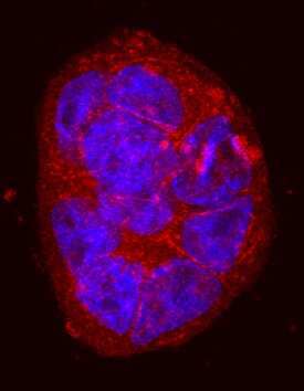 Integrin  beta 6 was detected in immersion fixed HT-29 human colon adenocarcinoma cell line using Sheep Anti-Human Integrin  beta 6 Biotinylated Antigen Affinity-purified Polyclonal Antibody (Catalog # BAF4155) at 10 µg/mL for 3 hours at room temperature. Cells were stained using the NorthernLights™ 557-conjugated Streptavidin (red; Catalog # NL999) and counterstained with DAPI(blue). Specific staining was localized to cytoplasm and cell surface. View our protocol for Fluorescent ICC Staining of Cells on Coverslips.