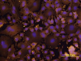 Integrin  beta 6 was detected in immersion fixed XB2 mouse teratoma keratinocyte cell line using Rat Anti-Mouse Integrin  beta 6 Monoclonal Antibody (Catalog # MAB2389) at 10 µg/mL for 3 hours at room temperature. Cells were stained using the NorthernLights™ 557-conjugated Anti-Rat IgG Secondary Antibody (yellow; Catalog # NL013) and counterstained with DAPI (blue). View our protocol for Fluorescent ICC Staining of Cells on Coverslips.