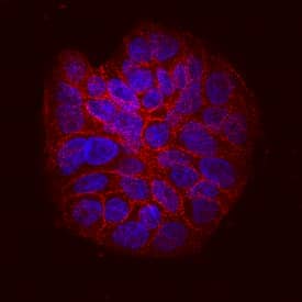 Integrin  beta 6 was detected in immersion fixed HT-29 human colon adenocarcinoma cell line using Mouse Anti-Human Integrin  beta 6 Monoclonal Antibody (Catalog # MAB4155) at 10 µg/mL for 3 hours at room temperature. Cells were stained using the NorthernLights™ 557-conjugated Anti-Mouse IgG Secondary Antibody (red; NL007) and counterstained with DAPI(blue). Specific staining was localized to cytoplasm and cell surface. View our protocol for Fluorescent ICC Staining of Cells on Coverslips.