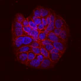 Integrin  beta 6 was detected in immersion fixed HT-29 human colon adenocarcinoma cell line using Mouse Anti-Human Integrin  beta 6 Monoclonal Antibody (Catalog # MAB4155) at 10 µg/mL for 3 hours at room temperature. Cells were stained using the NorthernLights™ 557-conjugated Anti-Mouse IgG Secondary Antibody (red; NL007) and counterstained with DAPI(blue). Specific staining was localized to cytoplasm and cell surface. View our protocol for Fluorescent ICC Staining of Cells on Coverslips.