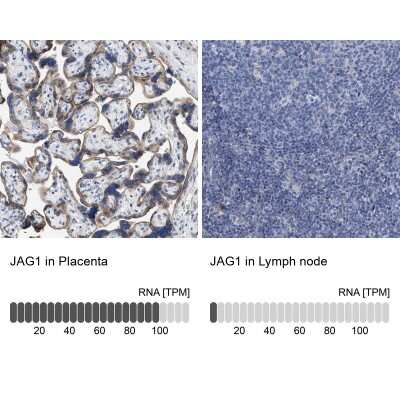 <b>Orthogonal Strategies Validation. </b>Immunohistochemistry-Paraffin: Jagged 1 Antibody [NBP1-90208] - Analysis in human placenta and lymph node tissues. Corresponding JAG1 RNA-seq data are presented for the same tissues.