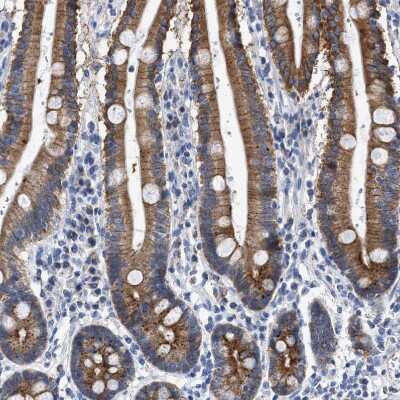 Immunohistochemistry-Paraffin: Jagged 1 Antibody [NBP1-90208] - Staining of human duodenum shows moderate cytoplasmic and membranous positivity in glandular cells.