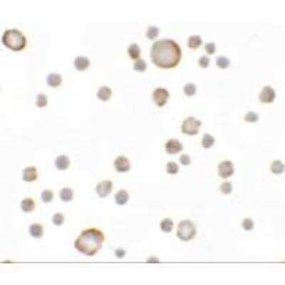Immunocytochemistry: KAL1 Antibody [NBP1-76580] - KAL1 in MCF7 cells with KAL1 antibody at 5 ug/mL.
