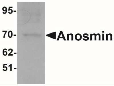 Western Blot: KAL1 Antibody [NBP1-76580] - Western blot analysis of Anosmin in MCF7 cell lysate with Anosmin antibody at 1 ug/mL.