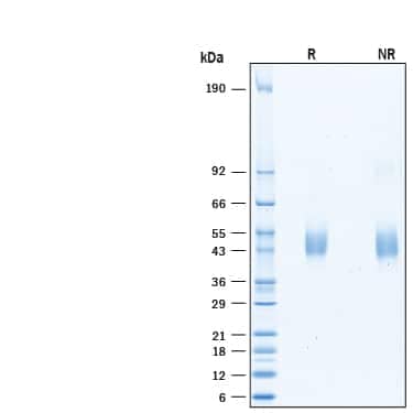 2 µg/lane of Recombinant Human KIR3DL3/CD158z (Catalog # 10454-KR ) was resolved by SDS-PAGE under reducing (R) and non-reducing (NR) conditions and visualized by Coomassie® Blue staining, showing bands at 42-47 kDa.