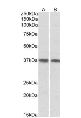 Western Blot: KLF2 Antibody [NB100-1051] - Staining of Human Heart (A) and Lung (B) lysates (35ug protein in RIPA buffer). Primary incubation was 1 hour. Detected by chemiluminescence.