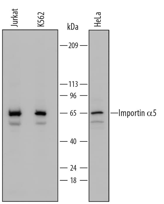 Western Blot Importin alpha 5/KPNA1/SRP1 Antibody