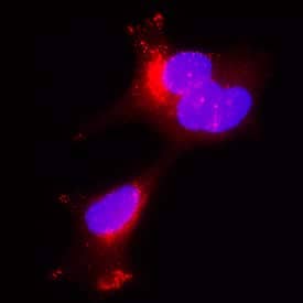     Kallikrein 3/PSA  was detected in immersion fixed LNCaP human prostate cancer cell line using  Mouse Anti-Human Kallikrein 3/PSA Monoclonal Antibody (Catalog #  MAB13443) at 25 µg/mL for 3 hours at room temperature.  Cells were stained using the NorthernLights™ 557-conjugated  Anti-Mouse IgG Secondary Antibody (red; Catalog # NL007)  and counterstained with DAPI (blue). Specific staining was localized to  cytoplasm. View our protocol for Fluorescent  ICC Staining of Cells on Coverslips. 