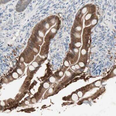 Immunohistochemistry-Paraffin: Ketohexokinase Antibody [NBP1-85790] - Staining of human small intestine shows moderate cytoplasmic positivity in glandular cells.