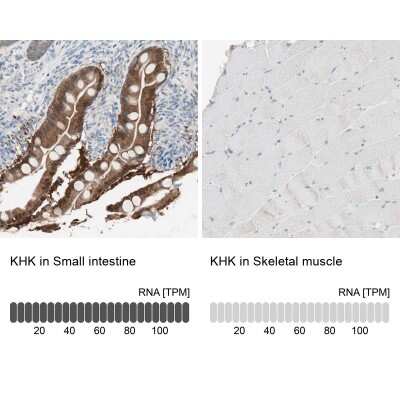 <b>Orthogonal Strategies Validation. </b>Immunohistochemistry-Paraffin: Ketohexokinase Antibody [NBP1-85790] - Staining in human small intestine and skeletal muscle tissues. Corresponding KHK RNA-seq data are presented for the same tissues.