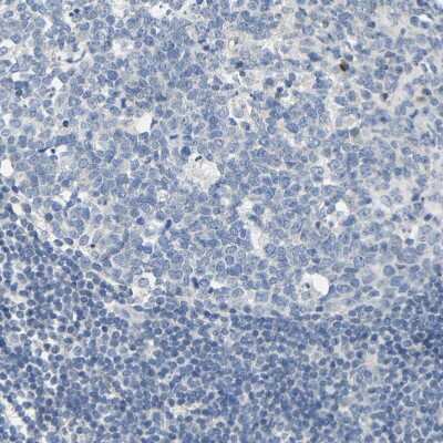 Immunohistochemistry-Paraffin: Kilon/NEGR1 Antibody [NBP1-83116] - Staining of human tonsil shows no positivity in germinal center cells as expected.