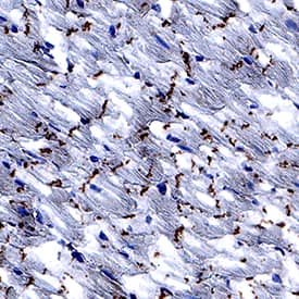     Kir2.1  was detected in perfusion fixed frozen sections of mouse heart using Rabbit  Anti-Human/Mouse Kir2.1 Monoclonal Antibody (Catalog # MAB9548) at  3 µg/mL for 1 hour at room temperature followed by  incubation with the Anti-Rabbit IgG VisUCyte™ HRP Polymer Antibody  (Catalog # VC003).  Tissue was stained using DAB (brown) and counterstained with hematoxylin  (blue).  Specific staining was  localized to intercalated discs. View our protocol for IHC  Staining with VisUCyte HRP Polymer Detection Reagents. 