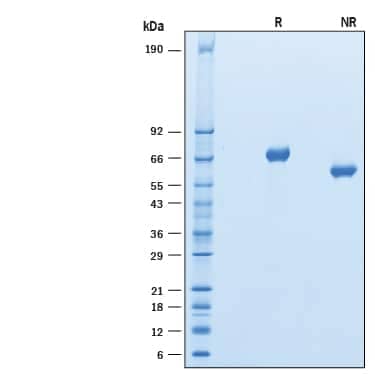 2 µg/lane of Recombinant Human Kirrel 1/NEPH1 His-tag (Catalog # 10165-K1) was resolved with SDS-PAGE under reducing (R) and non-reducing (NR) conditions and visualized by Coomassie® Blue staining, showing major bands at 65-75 kDa and 50-60 kDa, respectively.