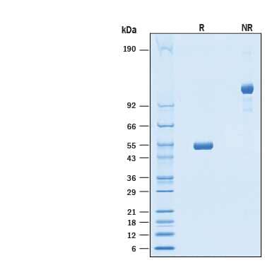 2 μg/lane of Recombinant Human LAIR2 Fc Chimera (Catalog # 10166-LR) was resolvedwith SDS-PAGE under reducing (R) and non-reducing (NR) conditions andvisualized by Coomassie® Blue staining, showing bands at 50-56 kDa and 100-120kDa, respectively.