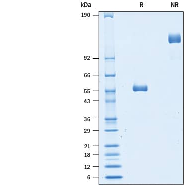 2 μg/lane of Recombinant Cynomolgus Monkey LAIR2 Fc Chimera (Catalog # 10340-LR) was  resolved with SDS-PAGE under reducing (R) and non-reducing (NR)  conditions and visualized by Coomassie® Blue staining, showing bands at 53-60 kDa and 100-120 kDa, respectively.