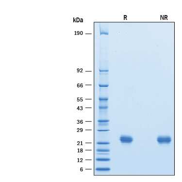 2 μg/lane of Biotinylated Recombinant Human LAIR2 His-Tag Avi-tag (Catalog # AVI2665)was resolved with SDS-PAGE under reducing (R) and non-reducing (NR) conditionsand visualized by Coomassie® Bluestaining, showing bands at 20-28 kDa.