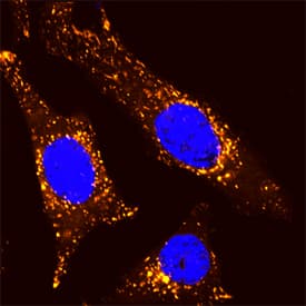 LAMP1/CD107a was detected in formaldehyde fixed HeLa human cervical epithelial carcinoma cell line using Sheep Anti-Human LAMP1/CD107a Lumenal Domain Biotinylated Antigen Affinity-purified Polyclonal Antibody (Catalog # BAF4800) at 15 µg/mL for 3 hours at room temperature. Cells were stained using the NorthernLights™ 557-conjugated Streptavidin (orange; Catalog # NL999) and counterstained with DAPI (blue). Specific staining was localized to lysosomes. View our protocol for Fluorescent ICC Staining of Cells on Coverslips.