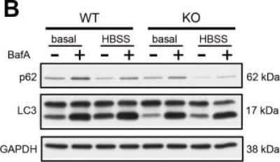 S. Typhimurium evades autophagy by disrupting Sirt1-dependent AMPK