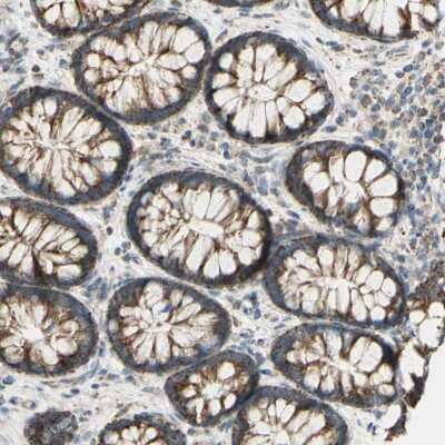 Immunohistochemistry-Paraffin: LETM1 Antibody [NBP1-89556] - Staining of human colon shows high expression.