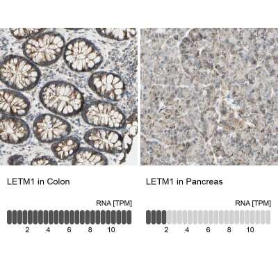<b>Orthogonal Strategies Validation. </b>Immunohistochemistry-Paraffin: LETM1 Antibody [NBP1-89556] - Staining in human colon and pancreas tissues using anti-LETM1 antibody. Corresponding LETM1 RNA-seq data are presented for the same tissues.