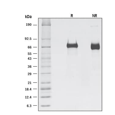 1 μg/lane ofRecombinant Human LILRB2/CD85d/ILT4 (Catalog #  8429-T4)was resolved with SDS-PAGE under reducing (R) and non-reducing (NR) conditionsand visualized by silver staining, showing bands at 69.9 and 66.8 kDa, respectively.