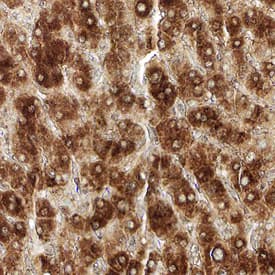 LIN-28B was detected in immersion fixed paraffin-embedded sections of human liver using Sheep Anti-Human LIN-28B Antigen Affinity-purified Polyclonal Antibody (Catalog # AF7726) at 15 µg/mL overnight at 4 °C. Tissue was stained using the Anti-Sheep HRP-DAB Cell & Tissue Staining Kit (brown; Catalog # CTS019) and counterstained with hematoxylin (blue). Specific staining was localized to cytoplasm in hepatocytes. View our protocol for Chromogenic IHC Staining of Paraffin-embedded Tissue Sections.