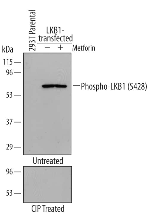 Western blot shows lysates of HEK293 human embryonic kidney cell line non-transfected and transfected with human LKB1/STK11 with or without metformin. PVDF membrane was probed with 1 µg/mL Rabbit Anti-Human Phospho-LKB1/STK11 (S428) Antigen Affinity-purified Polyclonal Antibody (Catalog # AF5636) followed by HRP-conjugated Anti-Rabbit IgG Secondary Antibody (Catalog # HAF008). A specific band for Phospho-LKB1/STK11 (S428) was detected at approximately 55 kDa (as indicated). This experiment was conducted under reducing conditions and using Immunoblot Buffer Group 1.