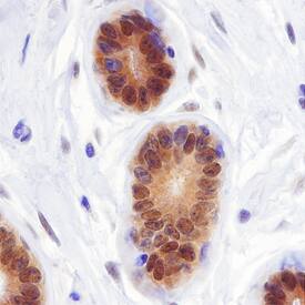 LKB1/STK11 was detected in formalin fixed paraffin-embedded sections of human breast tissue using Sheep Anti-Human LKB1/STK11 Antigen Affinity-purified Polyclonal Antibody (Catalog # AF8055) at 10 µg/mL overnight at 4 °C. Before incubation with the primary antibody, tissue was subjected to heat-induced epitope retrieval using Antigen Retrieval Reagent-Basic (Catalog # CTS013). Tissue was stained using the Anti-Sheep HRP-DAB Cell & Tissue Staining Kit (brown; Catalog # CTS019) and counterstained with hematoxylin (blue). Specific staining was localized to the cytoplasm and nuclei. View our protocol for Chromogenic IHC Staining of Paraffin-embedded Tissue Sections.