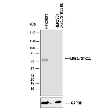 <b>Genetic Strategies Validation. </b>Western blot shows lysates of HEK293T human embryonic kidney parental cell line and LKB1/STK11 knockout HEK293T cell line (KO). PVDF membrane was probed with 2 µg/mL of Sheep Anti-Human LKB1/STK11 Antigen Affinity-purified Polyclonal Antibody (Catalog # AF8055) followed by HRP-conjugated Anti-Sheep IgG Secondary Antibody (Catalog # HAF016). A specific band was detected for LKB1/STK11 at approximately 54 kDa (as indicated) in the parental HEK293T cell line, but is not detectable in knockout HEK293T cell line. GAPDH (Catalog # AF5718) is shown as a loading control. This experiment was conducted under reducing conditions and using Immunoblot Buffer Group 1.