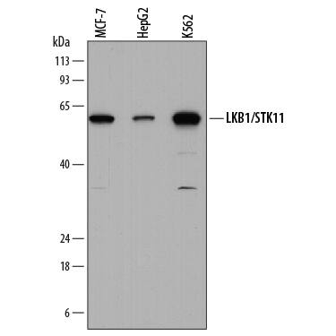 Western blot shows lysates of MCF-7 human breast cancer cell line, HepG2 human hepatocellular carcinoma cell line, and K562 human chronic myelogenous leukemia cell line. PVDF membrane was probed with 1 µg/mL of Mouse Anti-Human LKB1/STK11 Monoclonal Antibody (Catalog # MAB8055) followed by HRP-conjugated Anti-Mouse IgG Secondary Antibody (Catalog # HAF018). A specific band was detected for LKB1/STK11 at approximately 55 kDa (as indicated). This experiment was conducted under reducing conditions and using Immunoblot Buffer Group 1.