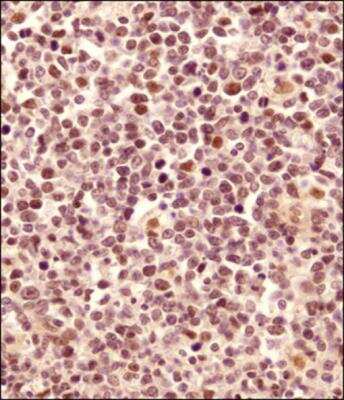 Immunohistochemistry-Paraffin: LMO2 Antibody [NB110-83978] - IHC analysis of a formalin fixed and paraffin embedded tissue section of human tonsil using LMO2 antibody NB110-83978 at 1:500 dilution. HRP-labeled secondary antibody and DAB reagent were used for the detection of LMO2 signal and the sections were further counterstained with hematoxylin. This LMO2 antibody generated an expected nuclear staining in a subset of cells in the germinal centers of tonsil section.