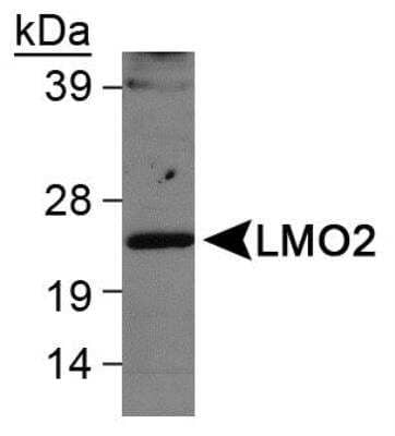 Western Blot: LMO2 Antibody [NB110-83978] - Detection of LMO2 in Ramos whole cell lysate using NB110-83978.