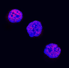 LMO2 was detected in immersion fixed K562 human chronic myelogenous leukemia cell line using Goat Anti-Human LMO2 Biotinylated Antigen Affinity-purified Polyclonal Antibody (Catalog # BAF2726) at 5 µg/mL for 3 hours at room temperature. Cells were stained using the NorthernLights™ 557-conjugated Streptavidin (red; Catalog # NL999) and counterstained with DAPI (blue). Specific staining was localized to nuclei. View our protocol for Fluorescent ICC Staining of Non-adherent Cells.