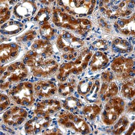 LRIG1 was detected in immersion fixed paraffin-embedded sections of human kidney using Sheep Anti-Human LRIG1 Antigen Affinity-purified Polyclonal Antibody (Catalog # AF7498) at 10 µg/mL overnight at 4 °C. Before incubation with the primary antibody, tissue was subjected to heat-induced epitope retrieval using Antigen Retrieval Reagent-Basic (Catalog # CTS013). Tissue was stained using the Anti-Sheep HRP-DAB Cell & Tissue Staining Kit (brown; Catalog # CTS019) and counterstained with hematoxylin (blue). Specific staining was localized to the cytoplasm of epithelial cells in convoluted tubules. View our protocol for Chromogenic IHC Staining of Paraffin-embedded Tissue Sections.