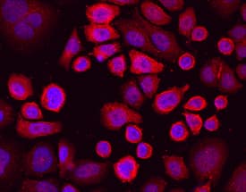 LRIG1 was detected in immersion fixed SK-BR-3 human breast cancer cell line using Mouse Anti-Human LRIG1 Monoclonal Antibody (Catalog # MAB7498) at 10 µg/mL for 3 hours at room temperature. Cells were stained using the Northern-Lights™ 557-conjugated Anti-Mouse IgG Secondary Antibody (red; Catalog # NL007) and counter-stained with DAPI (blue). Specific staining was localized to cytoplasm and cell surfaces. View our protocol for Fluorescent ICC Staining of Cells on Coverslips.