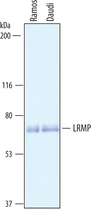 Western Blot LRMP/Jaw1 Antibody