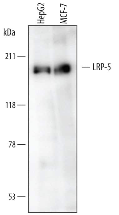 Western blot shows lysates of HepG2 human hepatocellular carcinoma cell line and MCF-7 human breast cancer cell line. PVDF membrane was probed with 2 µg/mL of Mouse Anti-Human LRP-5 Intracellular Domain Monoclonal Antibody (Catalog # MAB6646) followed by HRP-conjugated Anti-Mouse IgG Secondary Antibody (Catalog # HAF007). A specific band was detected for LRP-5 at approximately 185 kDa (as indicated). This experiment was conducted under reducing conditions and using Immunoblot Buffer Group 1.