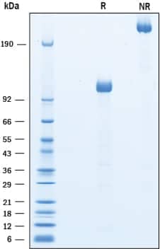 2 μg/lane of Recombinant Mouse LRP‑6 N-Terminal Fragment Fc Chimera was resolved with SDS-PAGE under reducing (R) and non-reducing (NR) conditions and visualized by Coomassie® blue staining, showing bands at 100-120 kDa and 200-220 kDa, respectively.