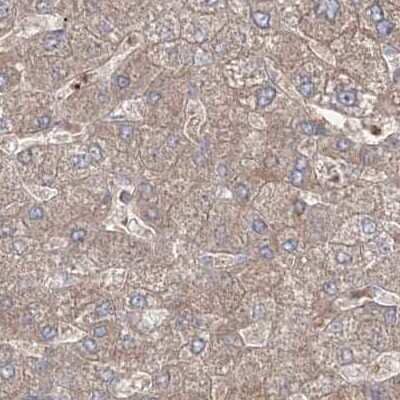 Immunohistochemistry-Paraffin: LRPPRC Antibody [NBP2-38300] - Staining of human liver.