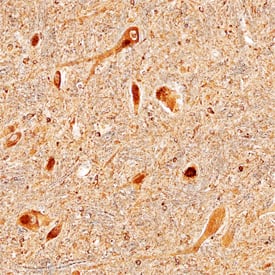 LRRC4 was detected in immersion fixed paraffin-embedded sections of human brain (medulla) using Mouse Anti-Human LRRC4 Monoclonal Antibody (Catalog # MAB49951) at 15 µg/mL overnight at 4 °C. Before incubation with the primary antibody, tissue was subjected to heat-induced epitope retrieval using Antigen Retrieval Reagent-Basic (Catalog # CTS013). Tissue was stained using the Anti-Mouse HRP-DAB Cell & Tissue Staining Kit (brown; Catalog # CTS002) and counterstained with hematoxylin (blue). Specific staining was localized to neuronal cell bodies, processes, and synaptic puncta. View our protocol for Chromogenic IHC Staining of Paraffin-embedded Tissue Sections.