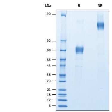 2 μg/lane of Recombinant Human LRRC52 Fc Chimera (Catalog # 10260-LR) was  resolved with SDS-PAGE under reducing (R) and non-reducing (NR)  conditions and visualized by Coomassie® Blue staining, showing bands at 60-80 kDa and 120 -140 kDa, respectively.